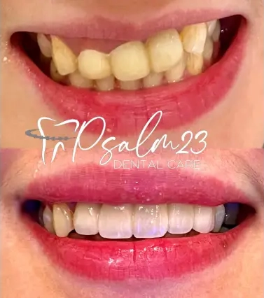 Psalm23 Dental Care cosmetic dentistry services