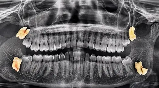 Psalm23 Dental Care oral surgery services