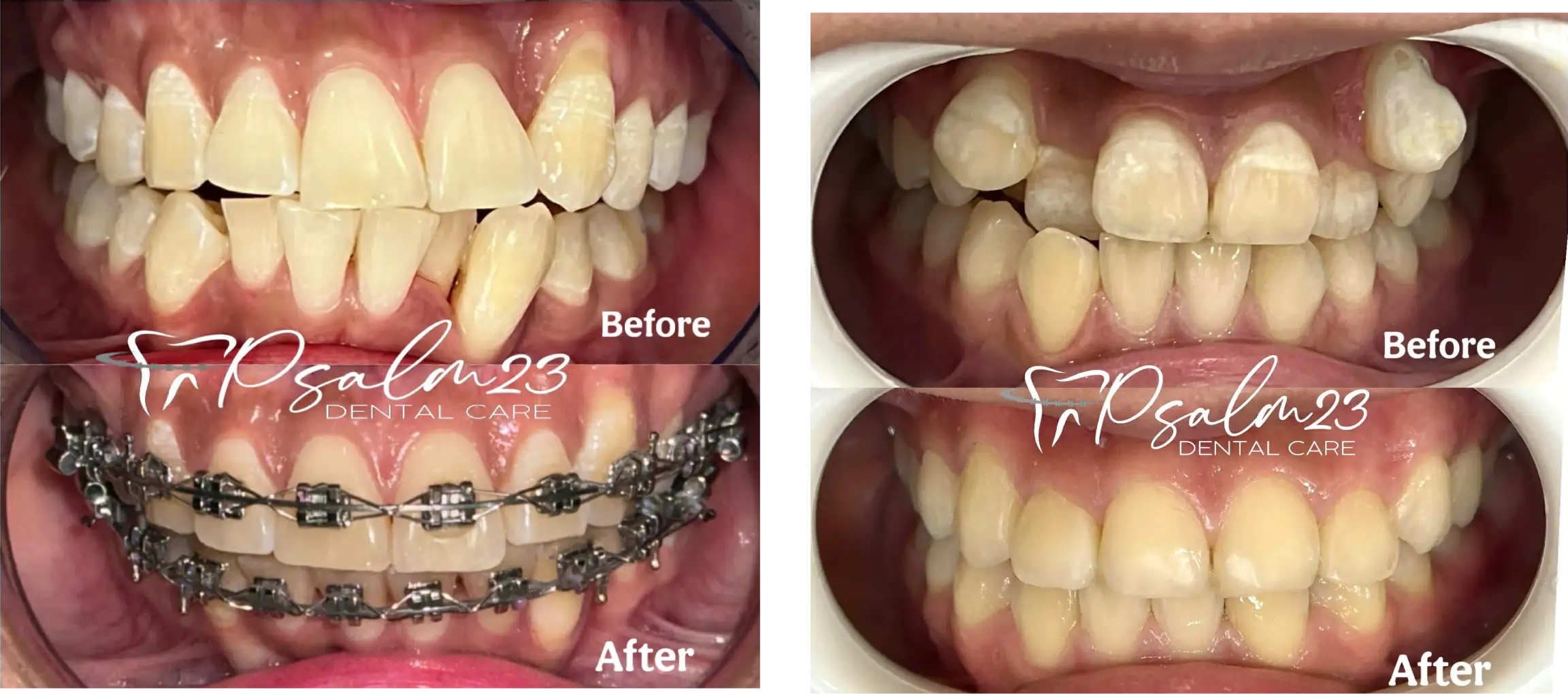 Psalm23 Dental Care orthodontic services